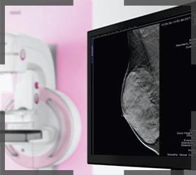 siemens-inspiration-mamografi-cihazi